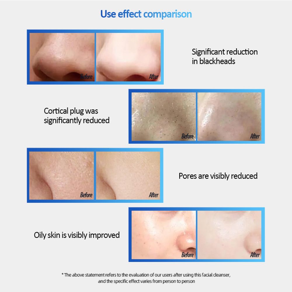 Facial Cleansing Brush, Sonic Facial Brush with 3 Brush Heads for Daily Skin Care, Rechargeable and Gentle Face Exfoliator