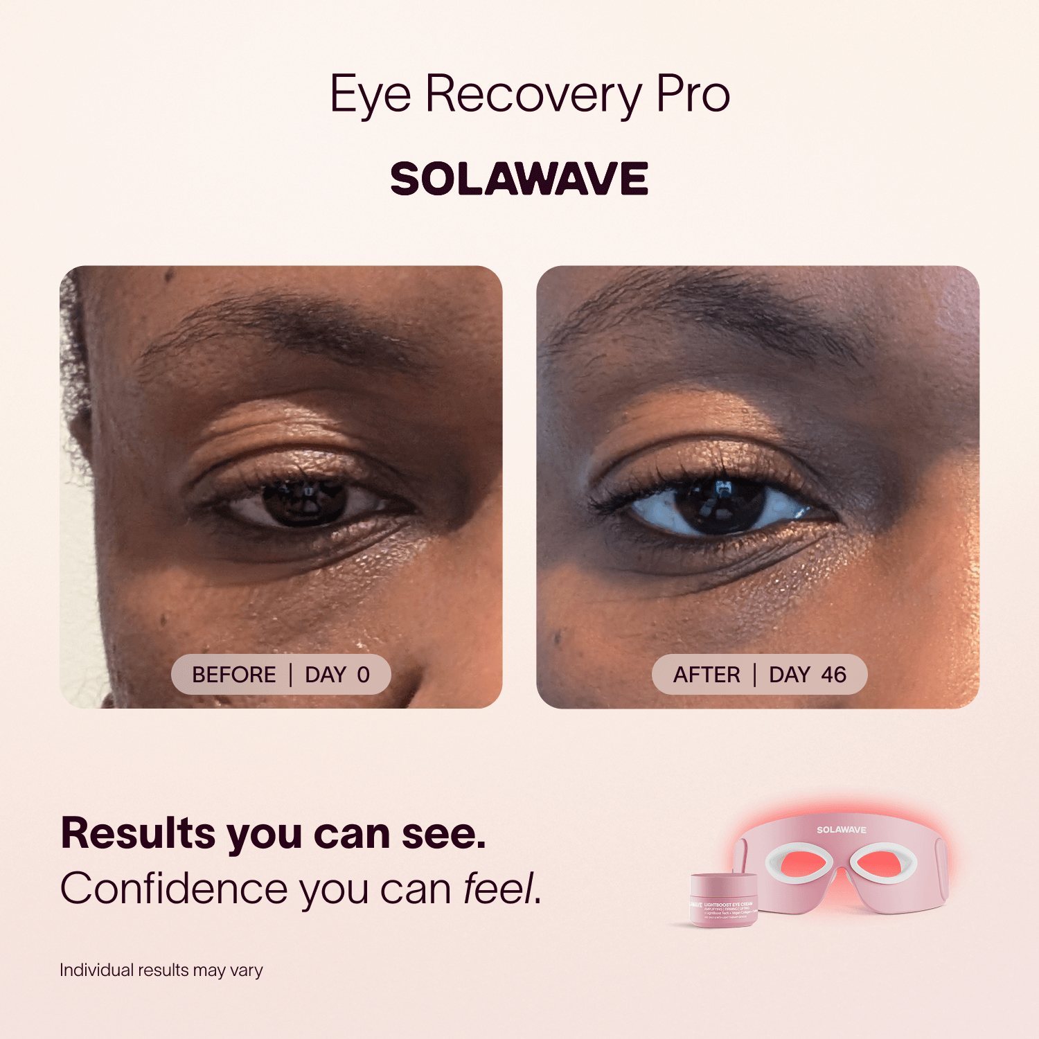 Eye Recovery Pro Kit