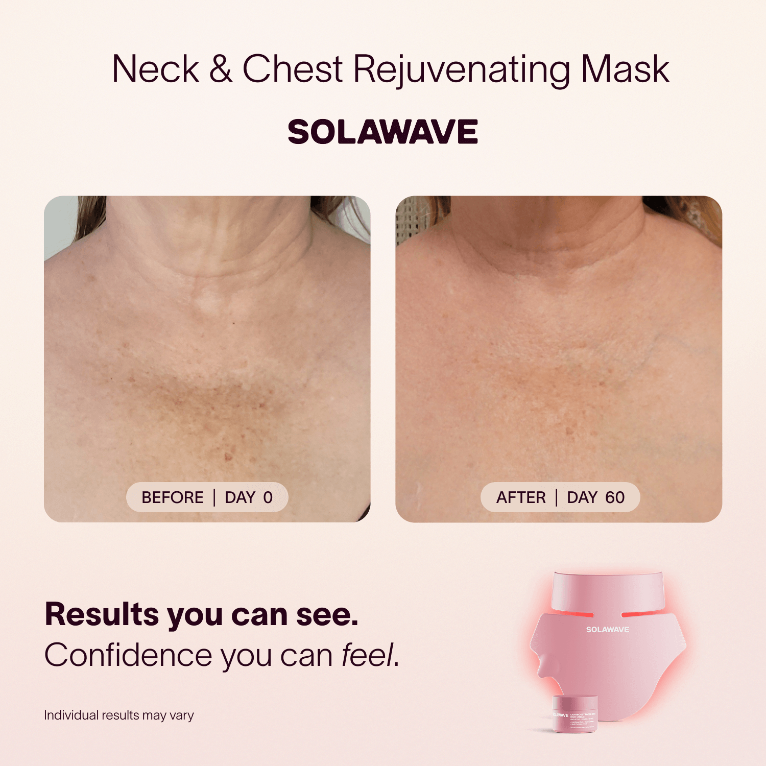 Neck & Chest LED Mask w/ LightBoost Cream Kit